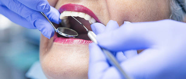 Best Emergency Tooth Extraction in Russell, KY